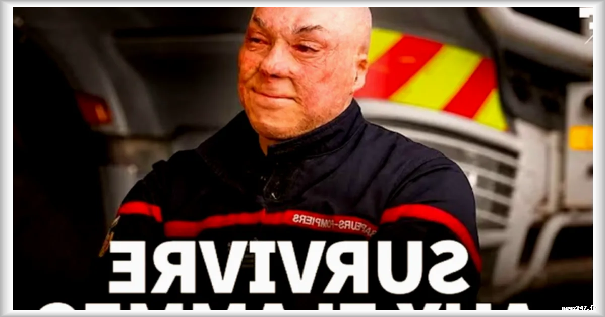 Frédéric Maggiani, pompier rescapé d’un incendie, raconte sa reconstruction après des mois de souffrance