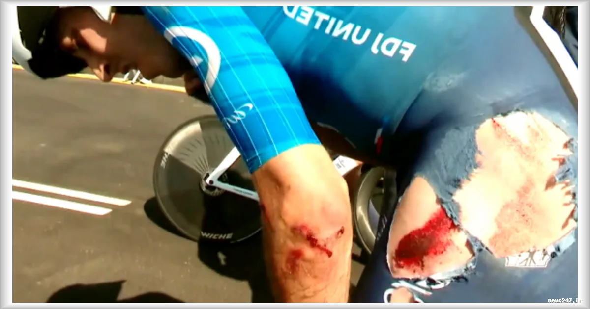Le Tour de France 2026 : les images impressionnantes des éraflures de Clément Berthet après sa chute