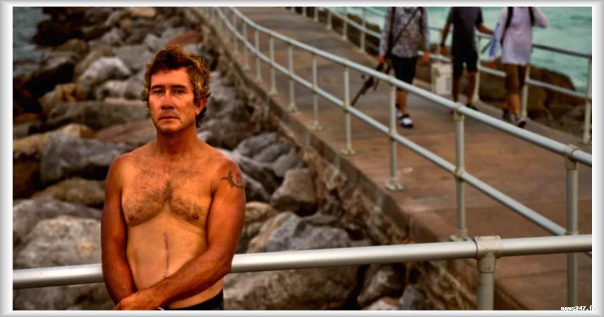 Les survivants de la foudre : un aperçu sur la vie après un foudroiement