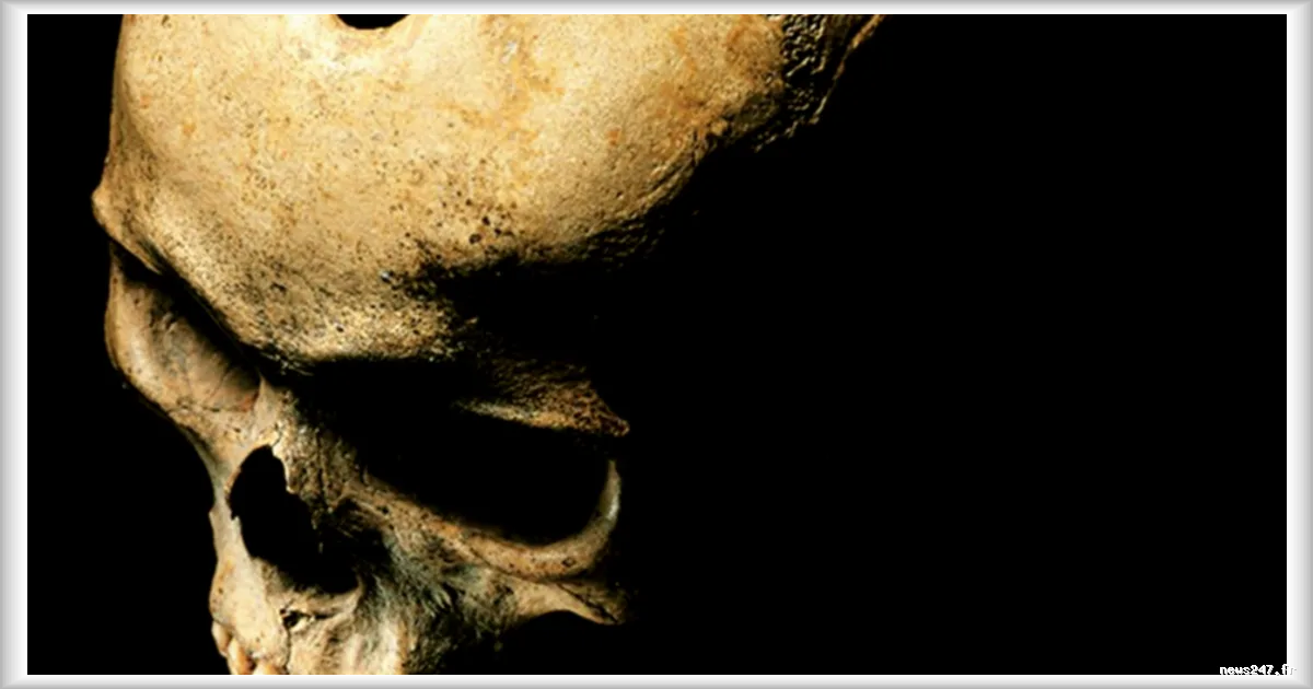 L'incroyable talent des chirurgiens du néolithique révélé par une découverte archéologique