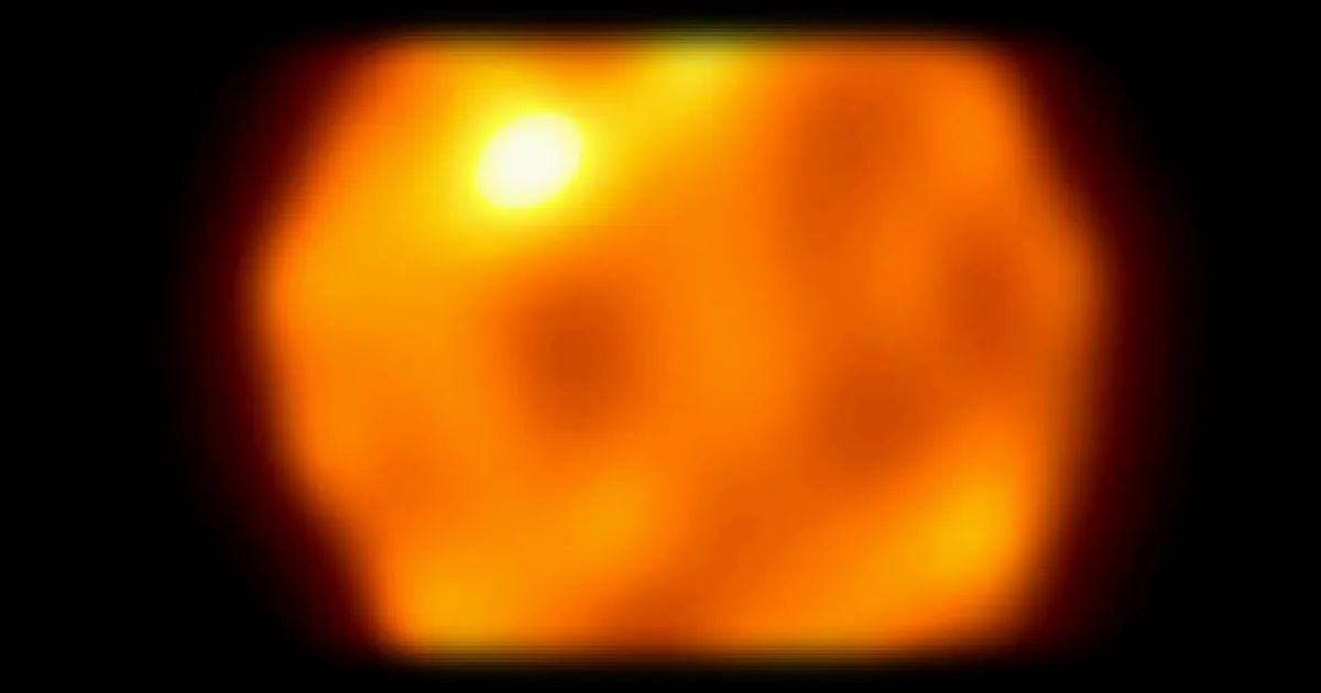 Bételgeuse sous l'œil d'Alma : une surface bouillonnante et un mystère persistant