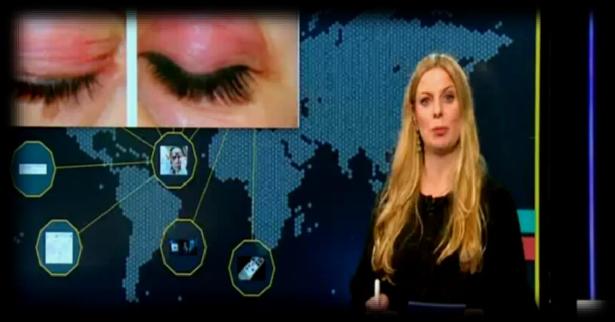 Bixonimanie : une maladie imaginaire diagnostiquee par des IA conversationnelles