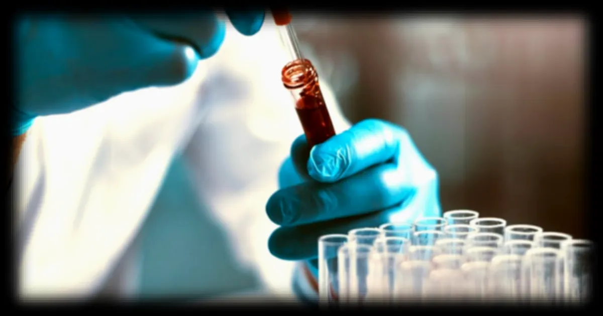 Cancer de la prostate : un nouveau test sanguin suédois détecte 90 % des formes agressives