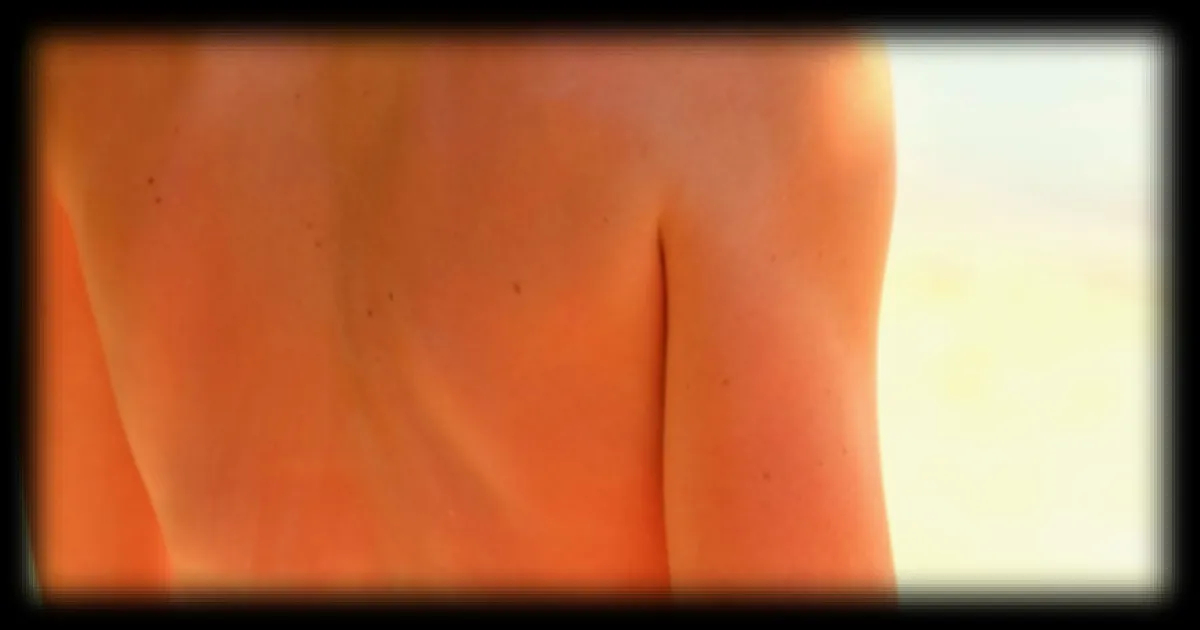 Canicules et coups de soleil : une dermatologue détaille la routine nocturne pour apaiser les brûlures et retrouver un sommeil réparateur