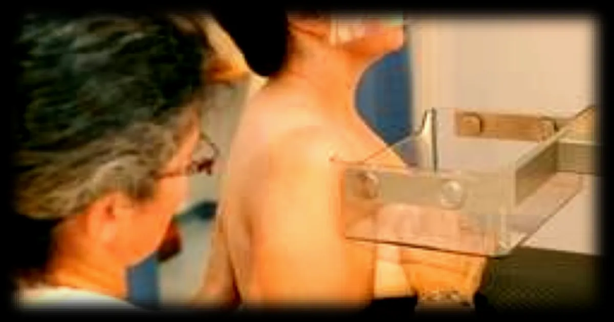 Dépistage précoce du cancer du sein : qui sont les femmes concernées avant 50 ans ?