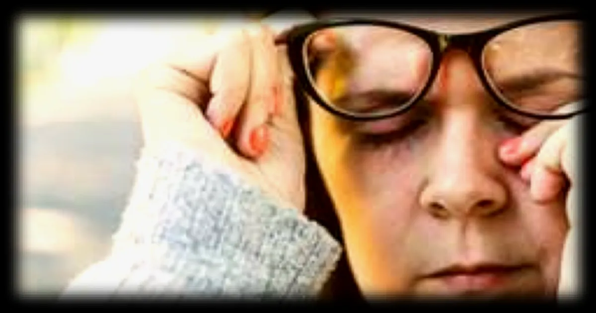 Des scientifiques ont cree une maladie fictive nommee bixonimanie