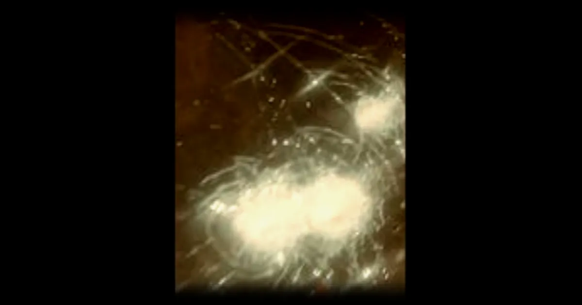 Inquiétude à Décines-Charpieu suite à des incidents de balles perdues et d'incendies