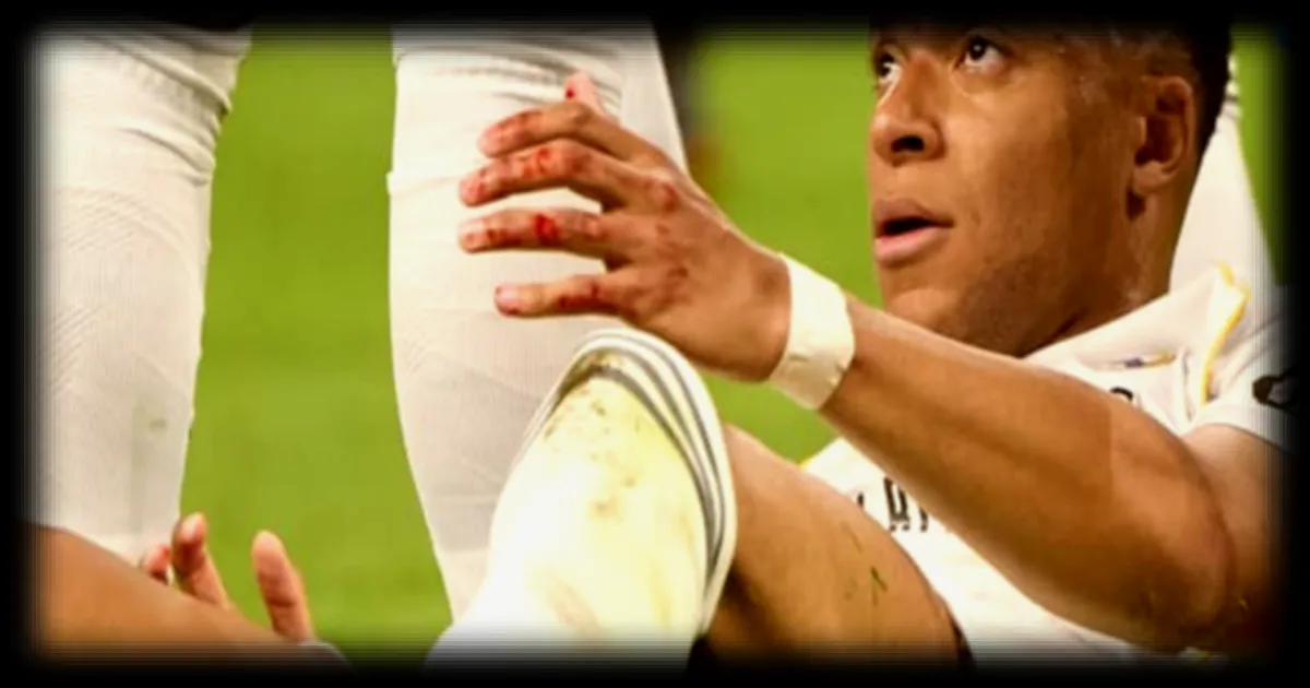 Kylian Mbappé absent de l'entraînement avant le match contre le Bayern Munich suite à une blessure à l'arcade