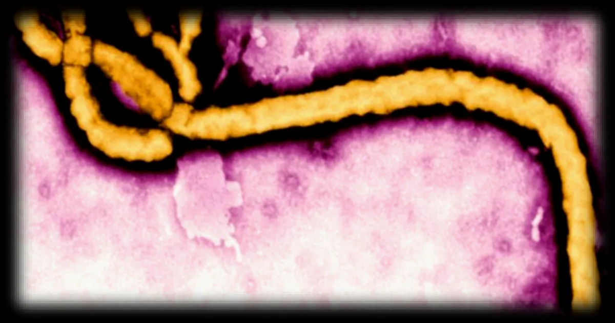 La Centrafrique renforce les mesures de prévention contre l'Ebola après la progression de l'épidémie en République démocratique du Congo