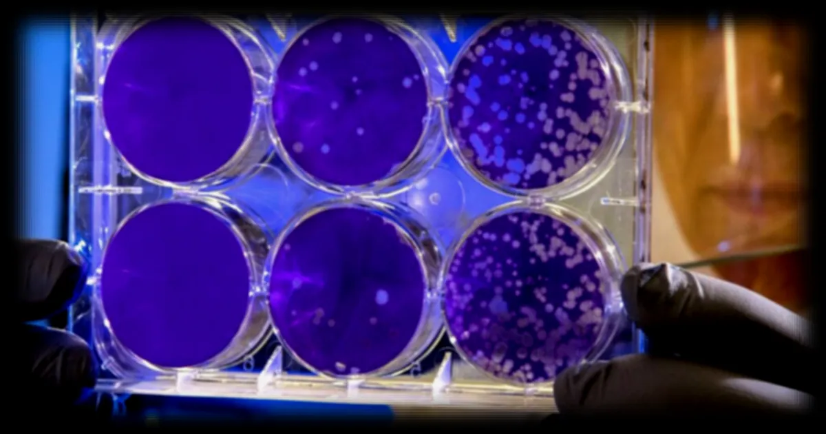 La fièvre typhoïde devient résistante aux antibiotiques : vers une nouvelle crise sanitaire ?