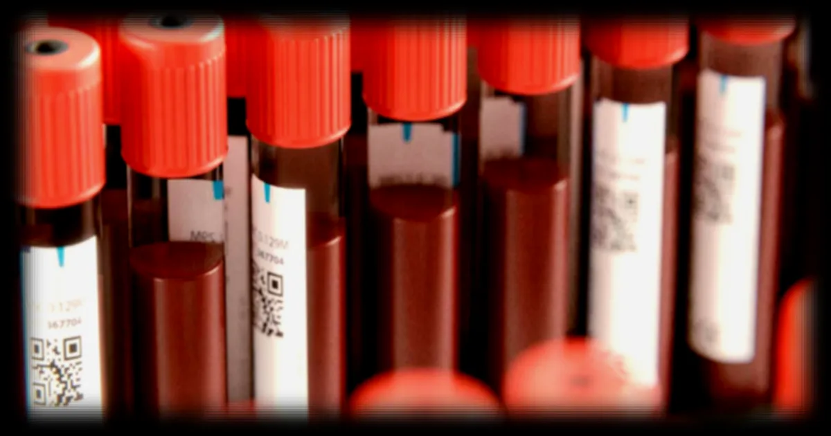 Le taux de CO2 atmosphérique affecte directement la santé humaine, selon une étude de vingt ans