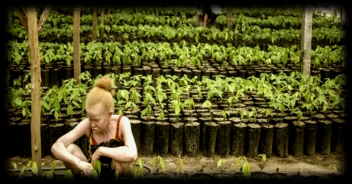 Madagascar : une vague d’attaques contre les personnes albinos relance les craintes et les appels à la sensibilisation