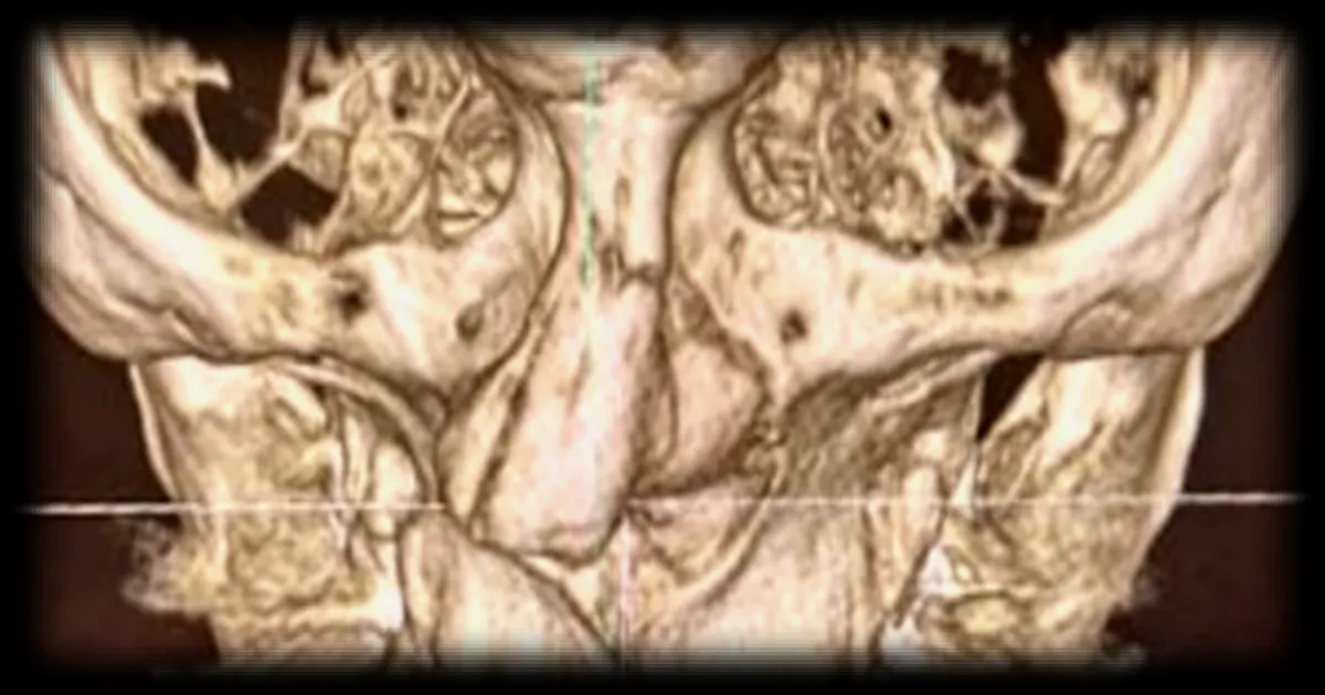 Merab Dvalishvili victime d'un accident à l'entraînement : le combattant géorgien refuse de se faire opérer