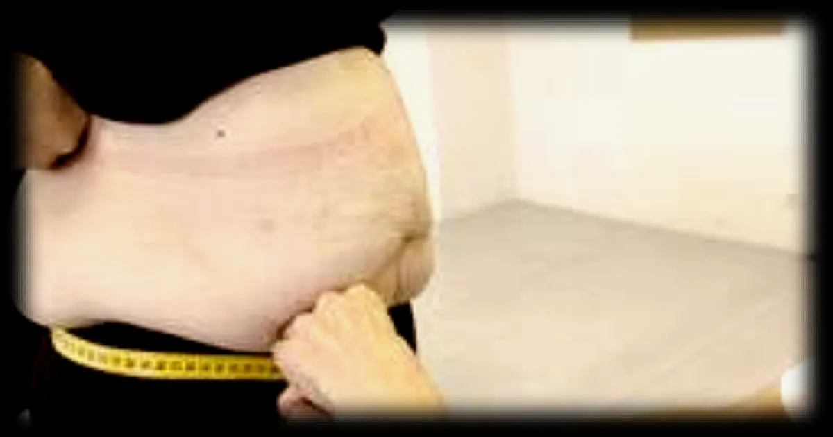 Obésité : Dix réponses de deux médecins spécialistes à vos questions