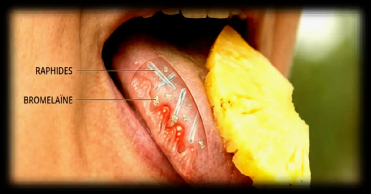 Pourquoi l'ananas peut provoquer une sensation de picotement sur la langue