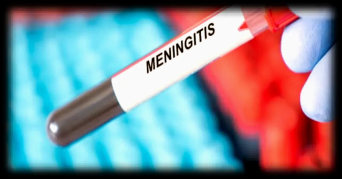 Trois cas de méningite, dont un mortel, signalés dans le sud de l'Angleterre