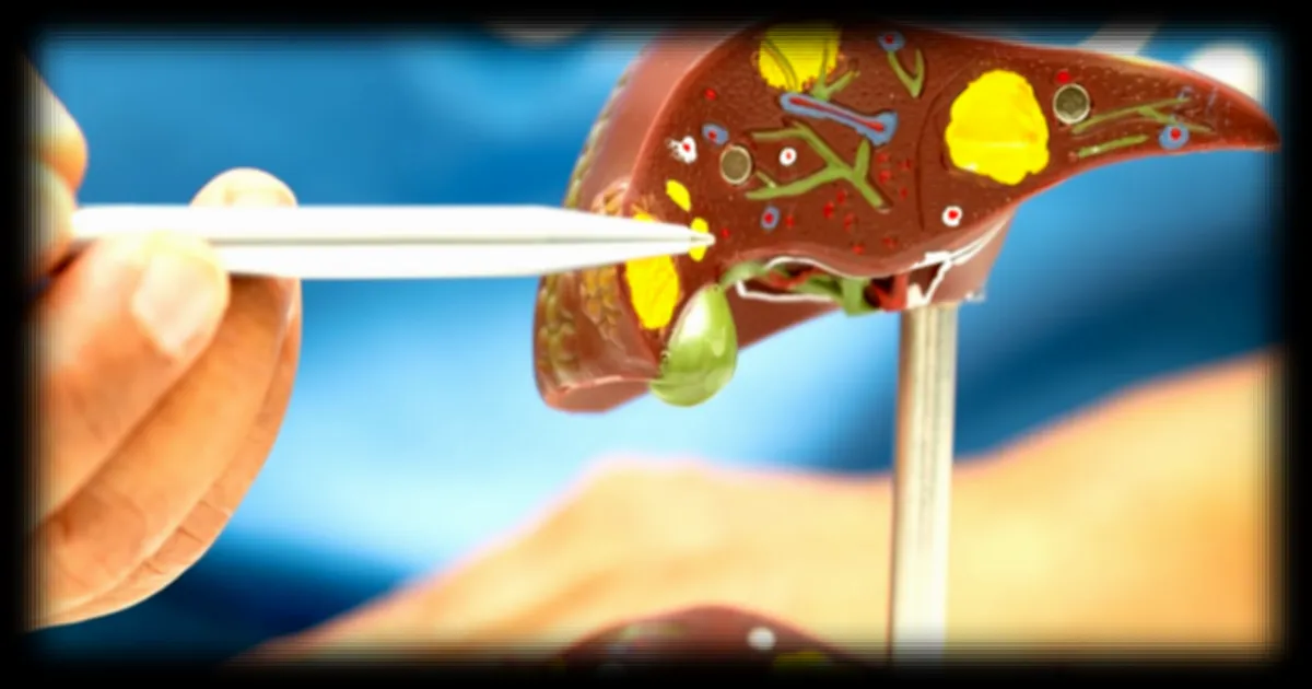 Un algorithme d’intelligence artificielle détecte précocement les risques de cancer du foie grâce aux données médicales existantes