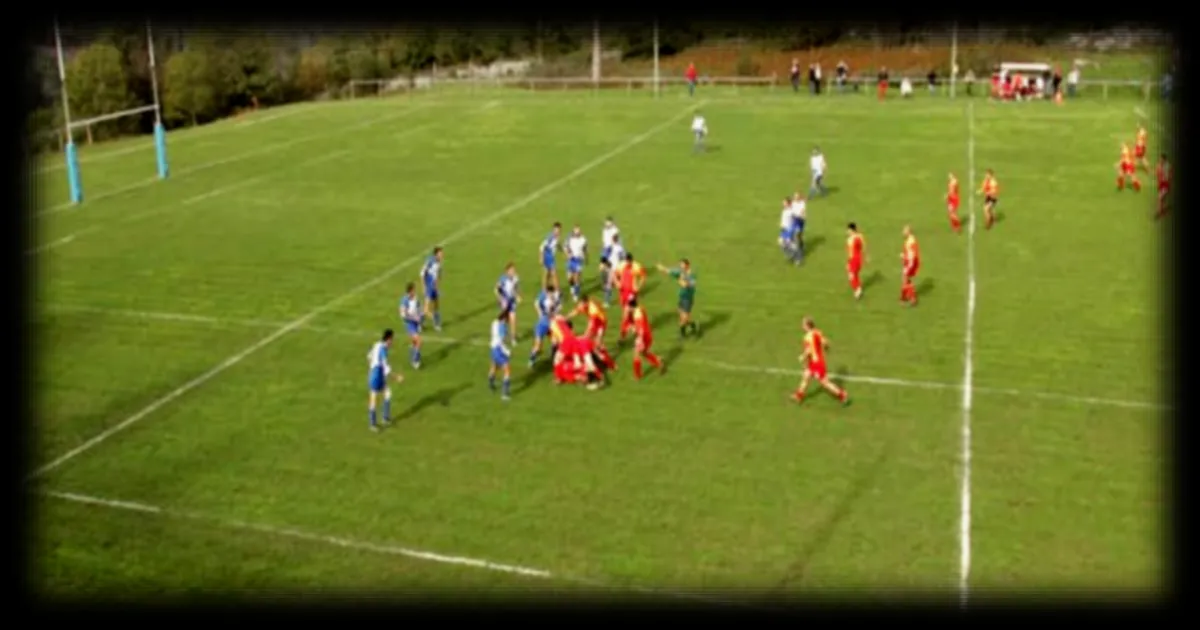 Un coup de poing à la tempe: pronostic vital engagé pour un rugbyman amateur