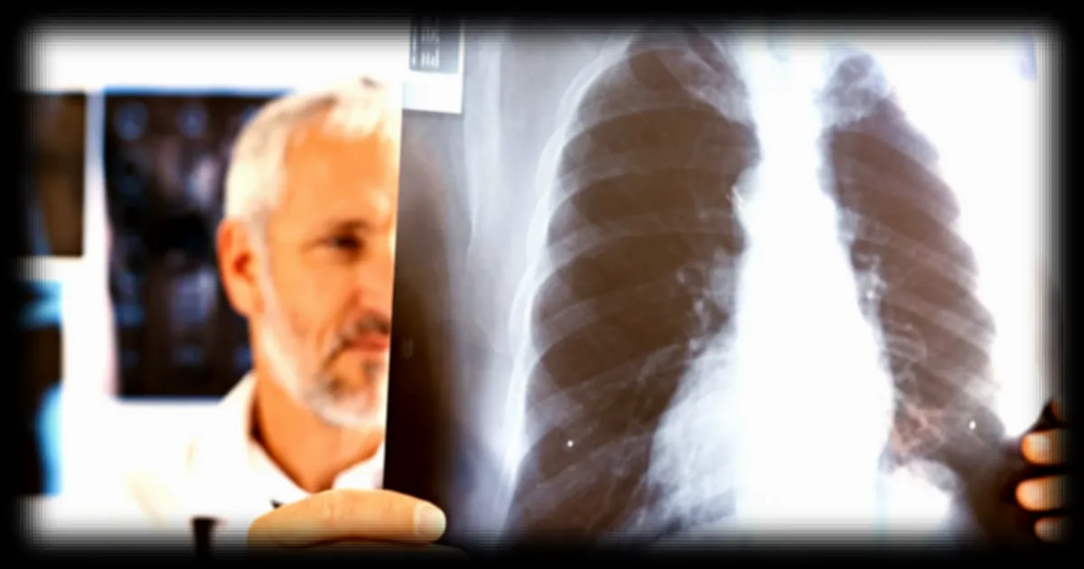 Un homme de 33 ans survit 48 heures sans poumons avec un poumon artificiel expérimental