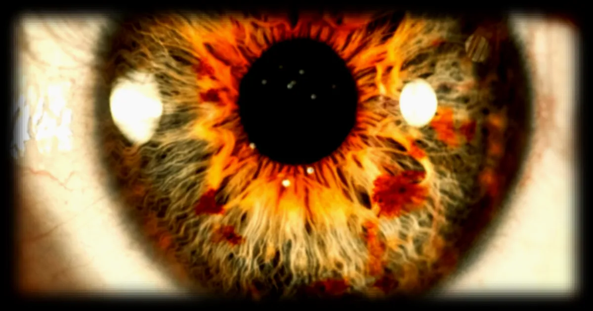 Un implant cérébral permet de recréer une vision artificielle chez un patient aveugle