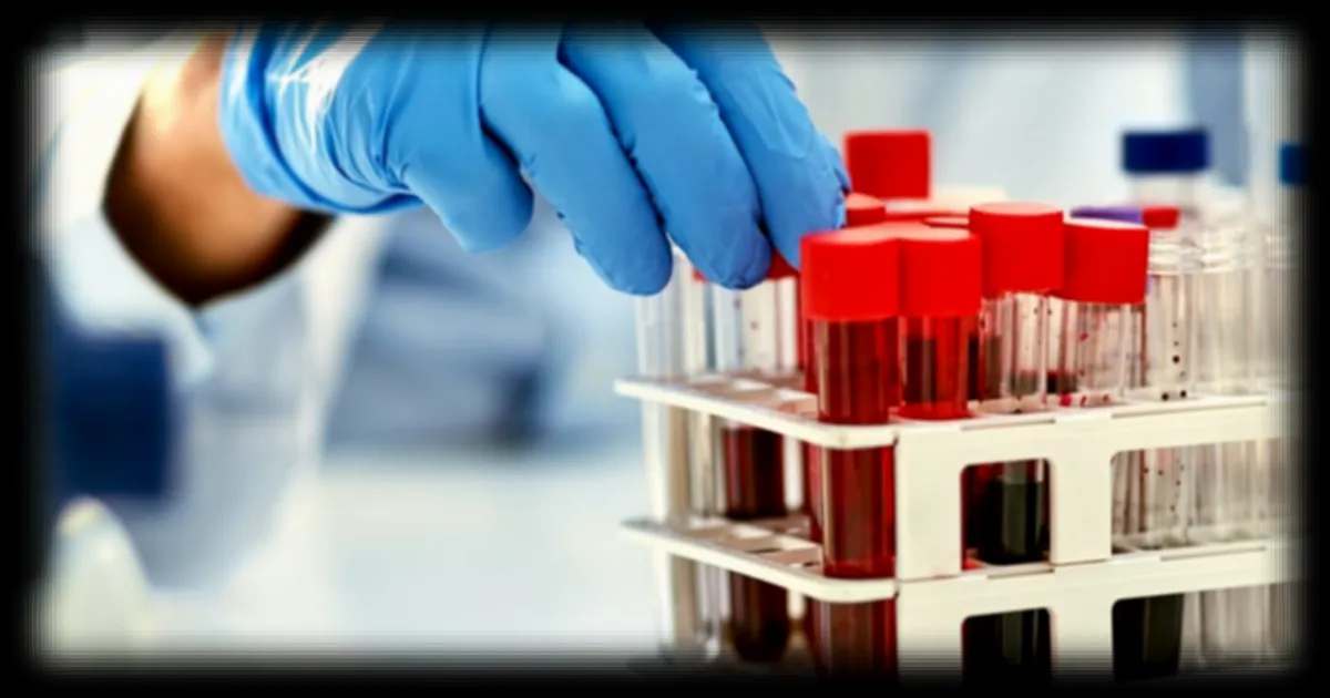 Un test sanguin à base d'ADN tumoral circulant pourrait éviter l'ablation de la vessie chez certains patients