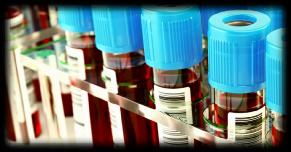 Un test sanguin pour détecter l'Alzheimer 25 ans à l'avance