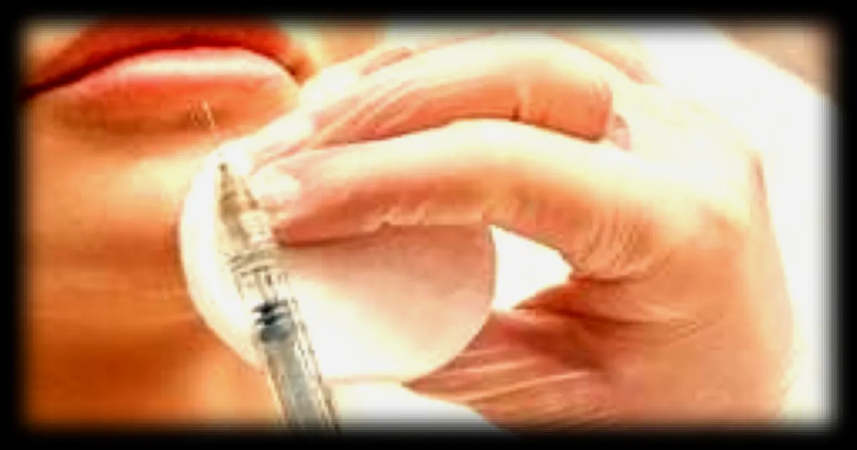 Une femme décède près de Lyon suite à une injection esthétique illégale, un suspect écroué