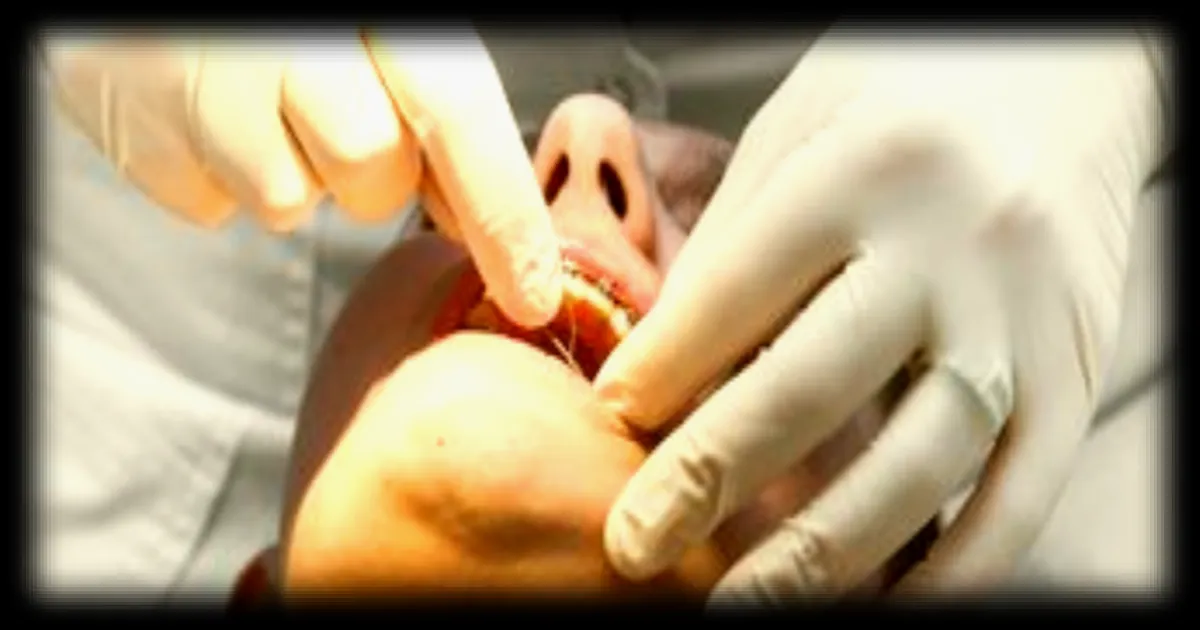 Une orthodontiste de Rouen radiée par l'Ordre des chirurgiens-dentistes pour escroquerie