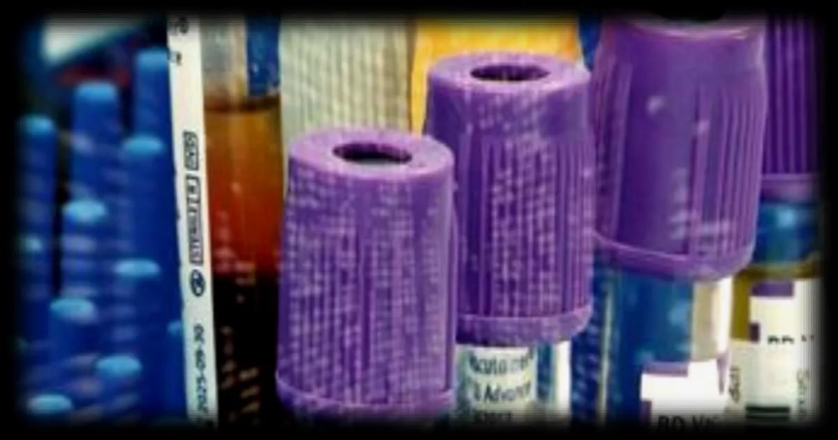 Vol massif de données chez les laboratoires Cerballiance : des informations médicales sensibles dérobées